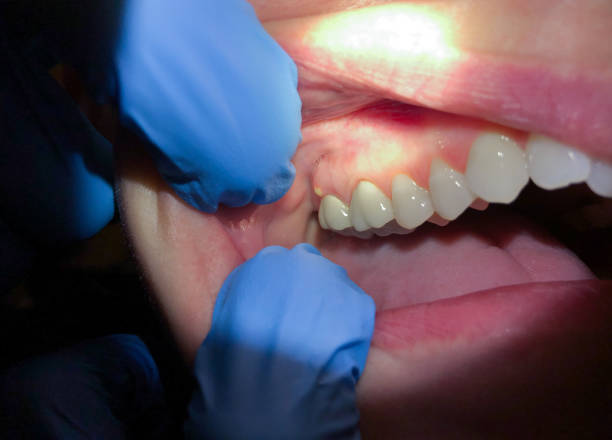 Best Orthodontic Emergency Dentist in Creve Coeur, MO