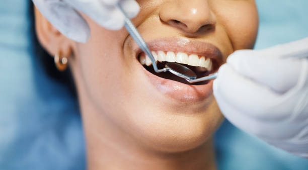 Best Mobile Emergency Dentist in Creve Coeur, MO